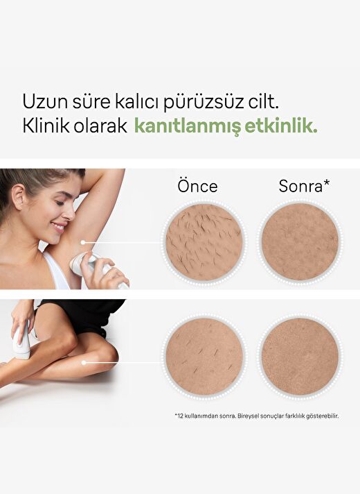 Braun IPL Silk·expert Pro 3, Evde Tüy Alma, Çanta, Venus Tıraş Makinesi, 2 Başlık ile, PL3132 4